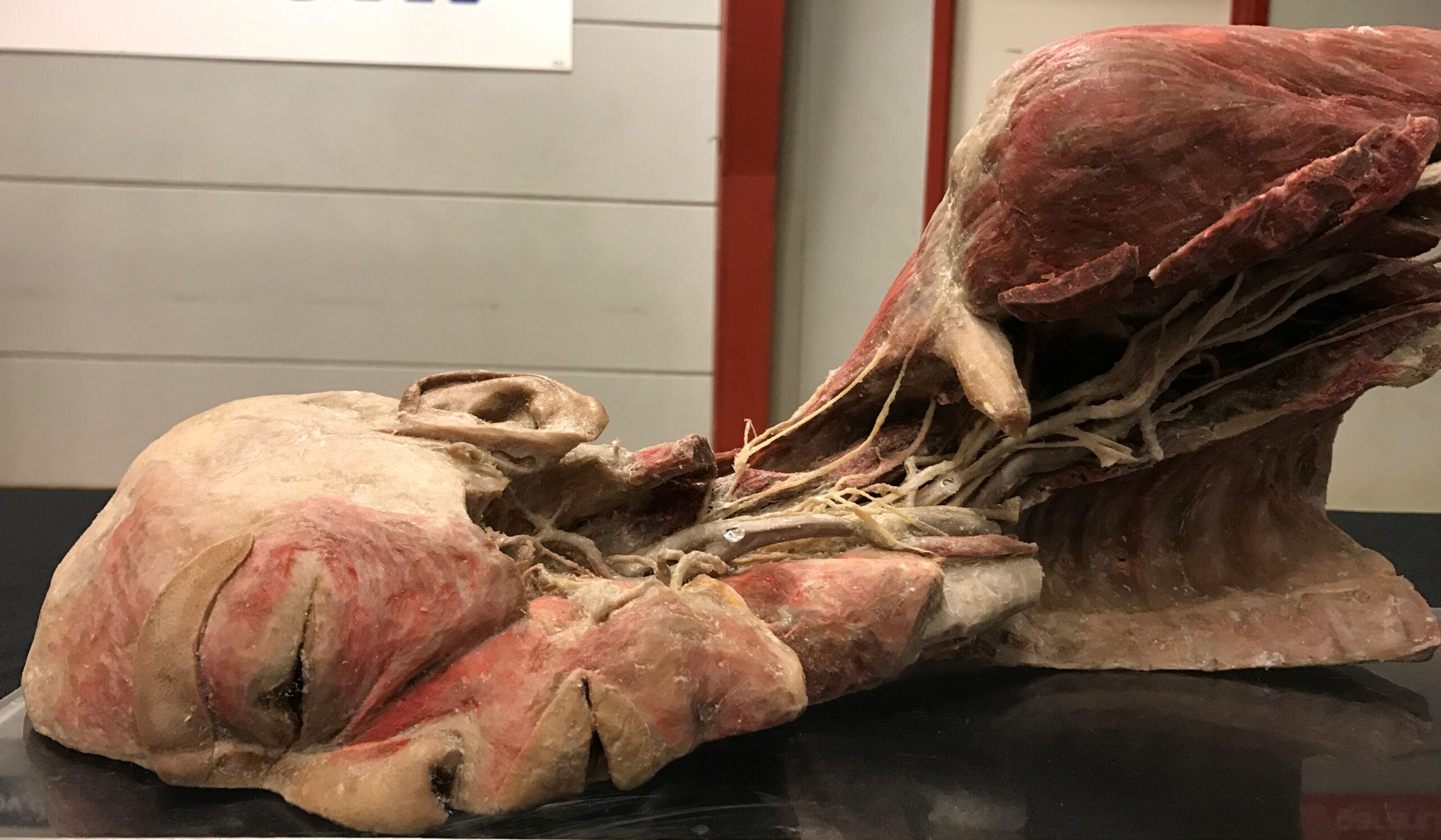 Expositie met echte lichamen in MartiniPlaza