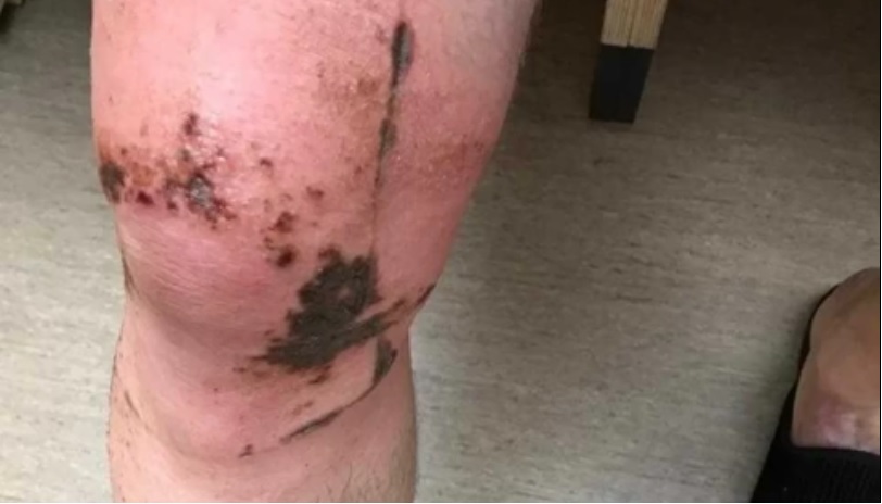 Man zwaargewond door aanval met bijtende vloeistof in Park Selwerd